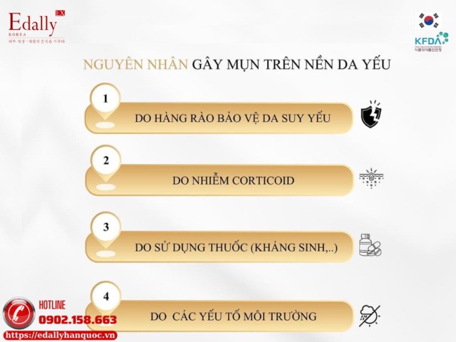 Những nguyên nhân gây mụn trên nền da yếu