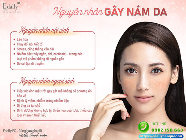 Nguyên nhân gây nám da là gì?