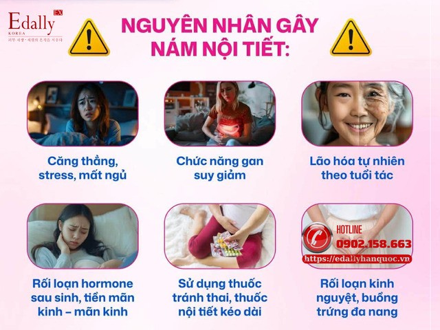 Những nguyên nhân gây nám nội tiết