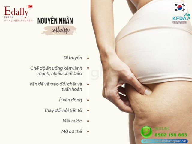 Nguyên nhân gây ra tình trạng da sần vỏ cam Cellulite