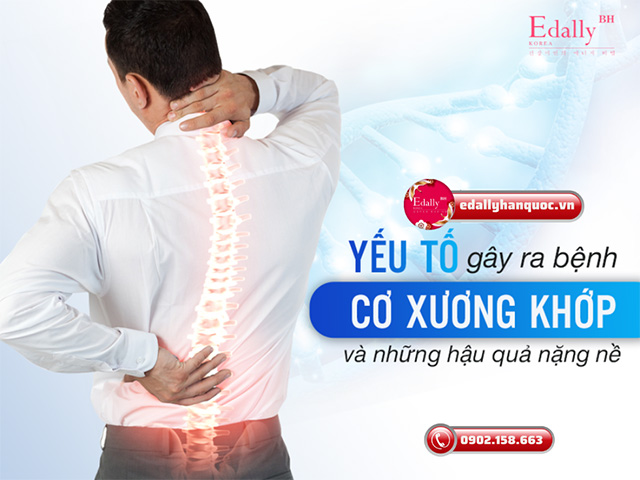 Nguyên nhân gây ra các bệnh lý cơ xương khớp là gì?