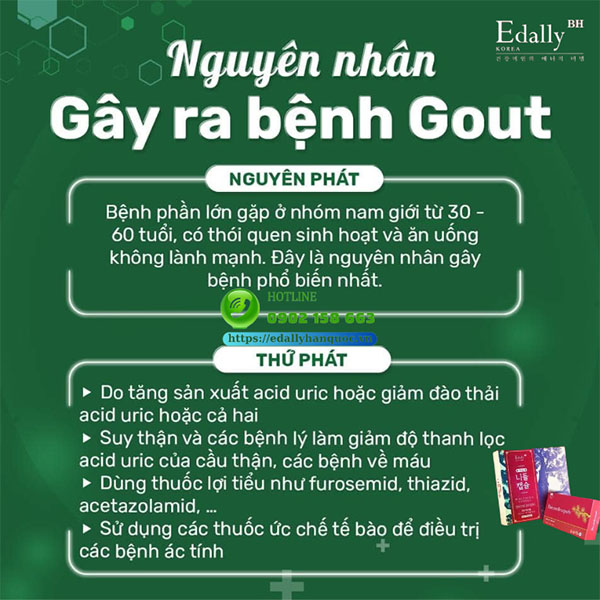 Nguyên nhân gây ra bệnh Gout là gì?