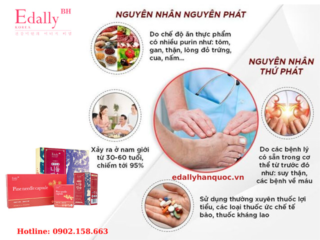 Những nguyên nhân gây bệnh gout