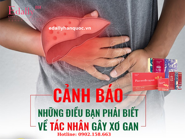 Nguyên Nhân Gây Xơ Gan Và Hướng Điều Trị Bệnh Xơ Gan