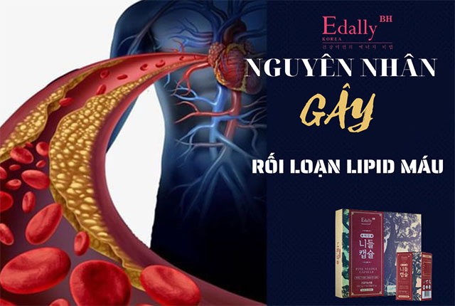 Nguyên Nhân Gây Rối Loạn Lipid Máu