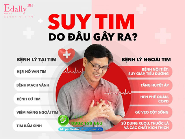 Nguyên nhân gây bệnh suy tim ở người trẻ