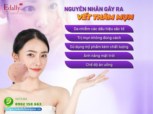 Những nguyên nhân gây ra thâm mụn