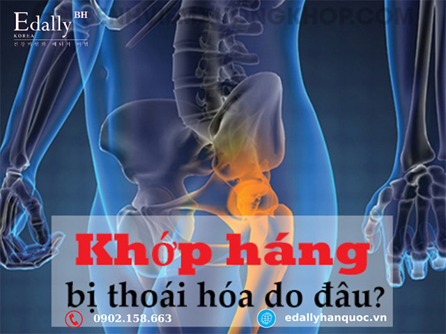 Bị thoái hóa khớp háng nguyên nhân do đâu?