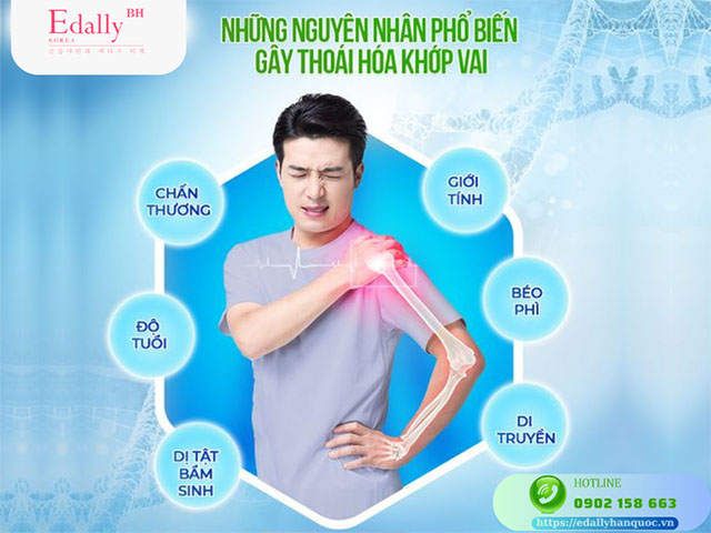 Những nguyên nhân phổ biến gây thoái hóa khớp vai