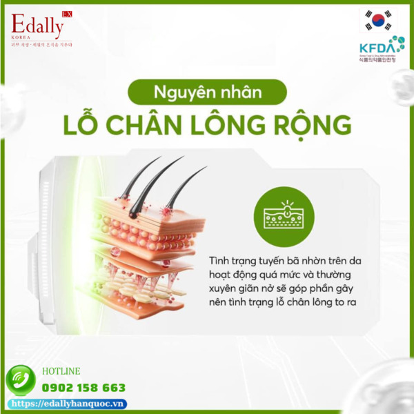 Những nguyên nhân gây nên tình trạng lỗ chân lông rộng