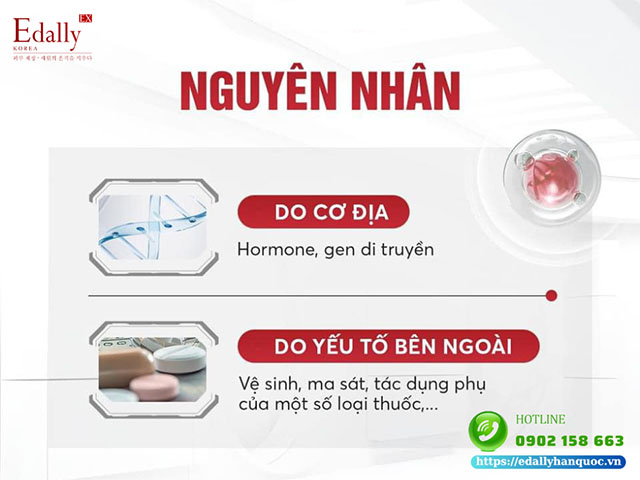 Nguyên nhân hình thành mụn trứng cá trên da