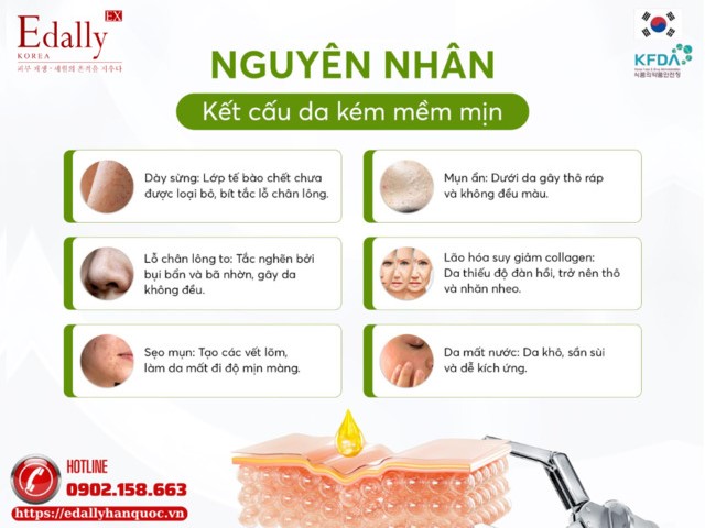 Nguyên nhân kết cấu da kém mềm mịn