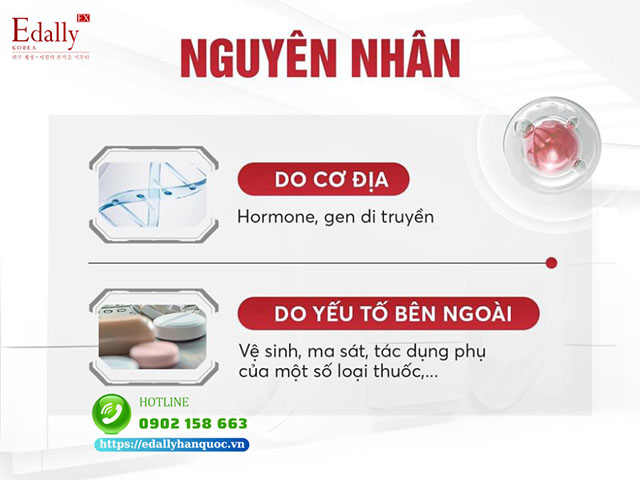 Những nguyên nhân khiến da bị mụn trứng cá