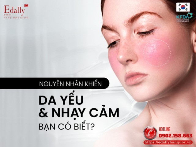 Da yếu và nhạy cảm- Vấn đề đang gia tăng trong đời sống thành thị, bạn có biết nguyên nhân?