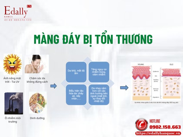 Màng đáy bị tổn thương và suy yếu là do đâu? Màng đáy bị tổn thương và suy yếu là do đâu?