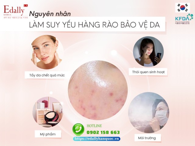 Nguyên nhân khiến hàng rào bảo vệ da bị suy yếu