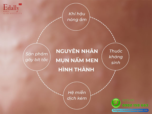 Nguyên nhân mụn nấm men hình thành