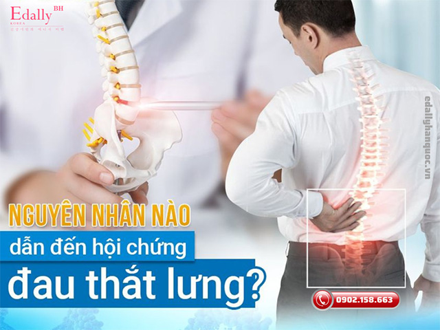 Nguyên nhân nào dẫn đến hội chứng đau thắt lưng ở phụ nữ và nam giới?