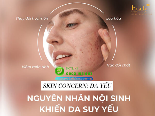 Những nguyên nhân nội sinh khiến da bị suy yếu