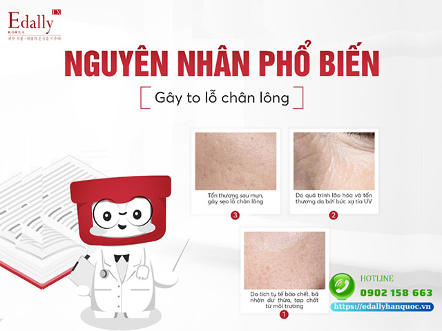 Những nguyên nhân phổ biến làm to lỗ chân lông