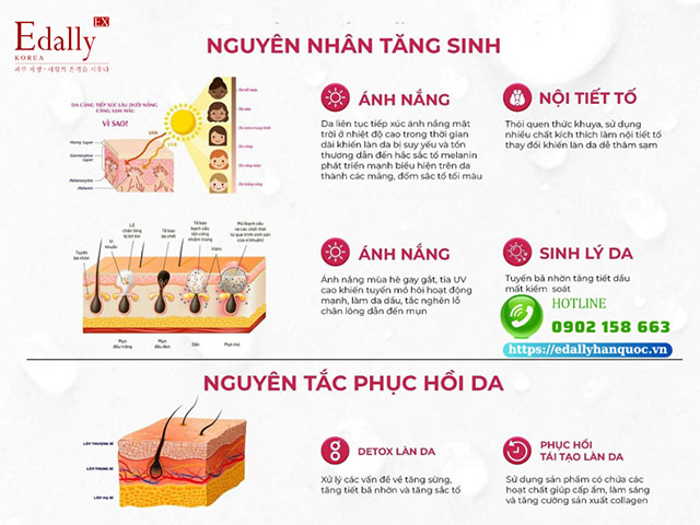 Nguyên nhân tăng sinh sắc tố da cục bộ và mụn sau hè