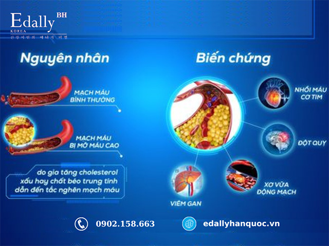 Bệnh mỡ máu cao là hung thủ thầm lặng của nhiều biến chứng nguy hiểm