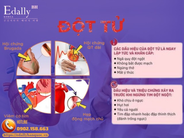 Nguyên nhân và triệu chứng của đột tử (ngừng tim đột ngột)