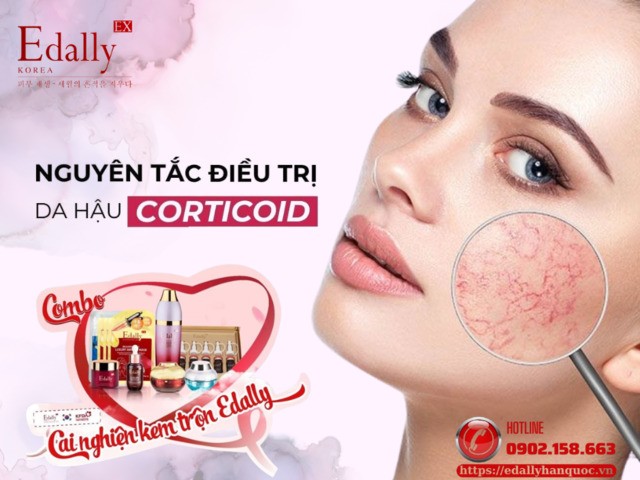 Nguyên Tắc Điều Trị Da Hậu Corticoid An Toàn, Hiệu Quả