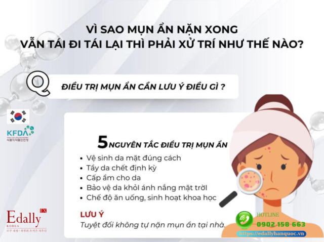 5 nguyên tắc điều trị mụn ẩn