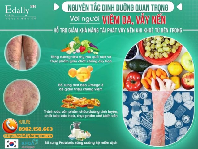 Nguyên tắc dinh dưỡng quan trọng cho người bệnh viêm da và vảy nến