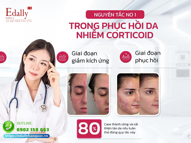 Nguyên tắc số 1 khi chăm sóc da nhiễm Corticoid