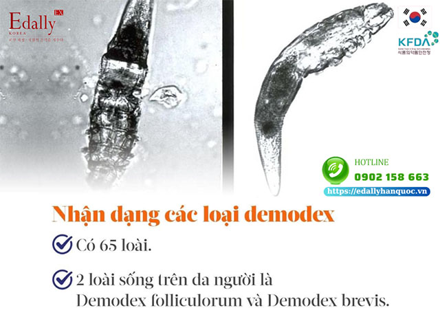 Các loại ký sinh trùng demodex sống trên da người