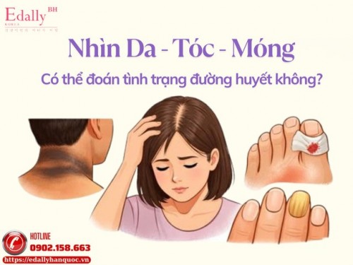 Nhìn Da - Tóc - Móng Có Thể Đoán Tình Trạng Đường Huyết?