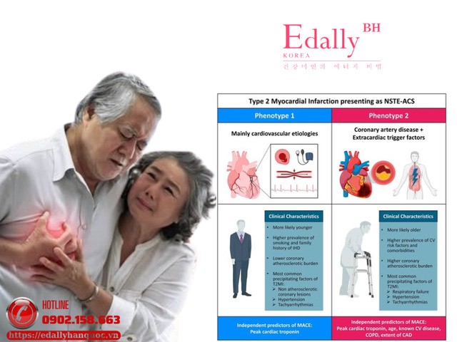 Nhồi máu cơ tim type 2: Không còn do mảng xơ vữa gây ra