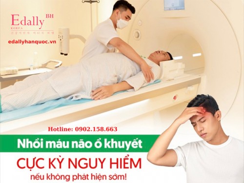 Nhồi Máu Não Ổ Khuyết Nguy Hiểm Thế Nào?