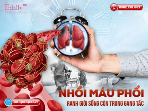 Nhồi Máu Phổi - Ranh Giới Sống Còn Trong Gang Tấc