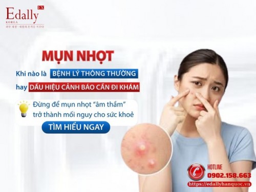 Nhọt - Khi Nào Là Bình Thường Và Khi Nào Là Dấu Hiệu Cảnh Báo? 