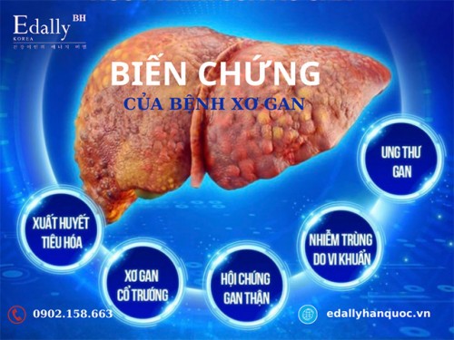 Biến Chứng Nguy Hiểm Của Bệnh Xơ Gan