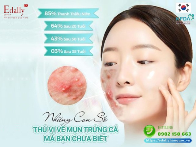 Những con số về mụn trứng cá mà bạn nên biết