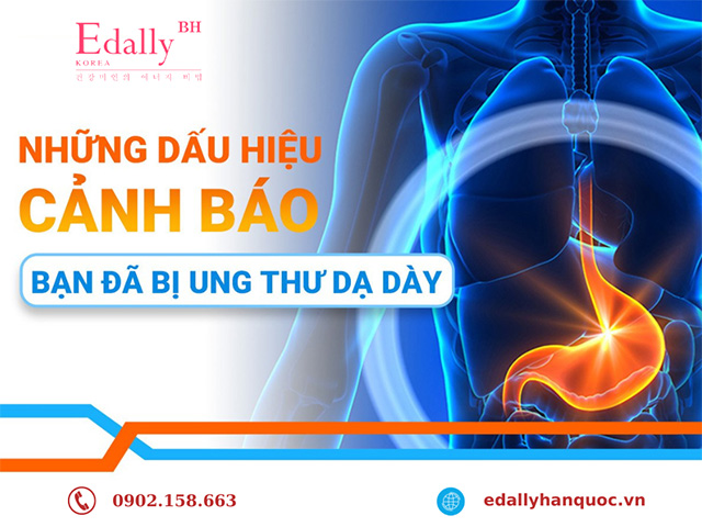 Những dấu hiệu cảnh báo bạn có nguy cơ mắc bệnh ung thư dạ dày là gì?