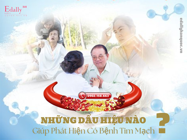 Những dấu hiệu nào giúp người bệnh phát hiện mắc bệnh tim mạch?