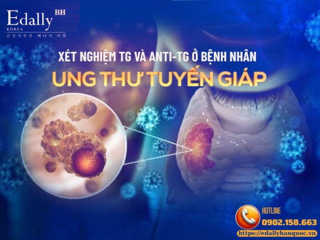 Những điều cần biết về xét nghiệm Tg và Anti-Tg ở bệnh nhân ung thư tuyến giáp