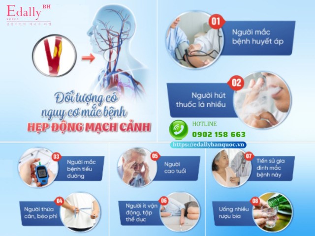 Những đối tượng dễ bị hẹp và tắc nghẽn động mạch cảnh