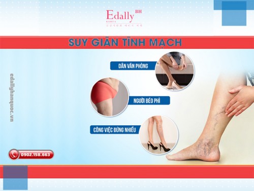 Những Đối Tượng Nào Dễ Bị Suy Giãn Tĩnh Mạch?