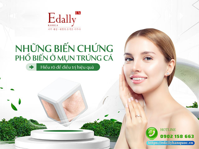 Những hậu quả thường gặp của mụn trứng cá - Hiểu rõ để điều trị hiệu quả