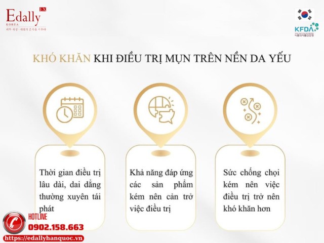 Những khó khăn khi điều trị mụn trên nền da yếu