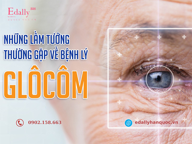 Một số lầm tưởng khi mắc bệnh Glôcôm