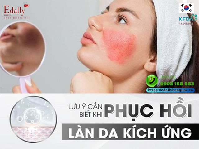 Những lưu ý cần biết khi phục hồi làn da kích ứng