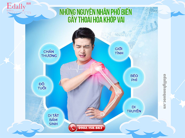 Những nguyên nhân phổ biến gây thoái hóa khớp vai