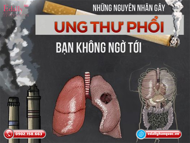 Những nguyên nhân gây ​​​bệnh Ung thư phổi mà bạn không ngờ tới